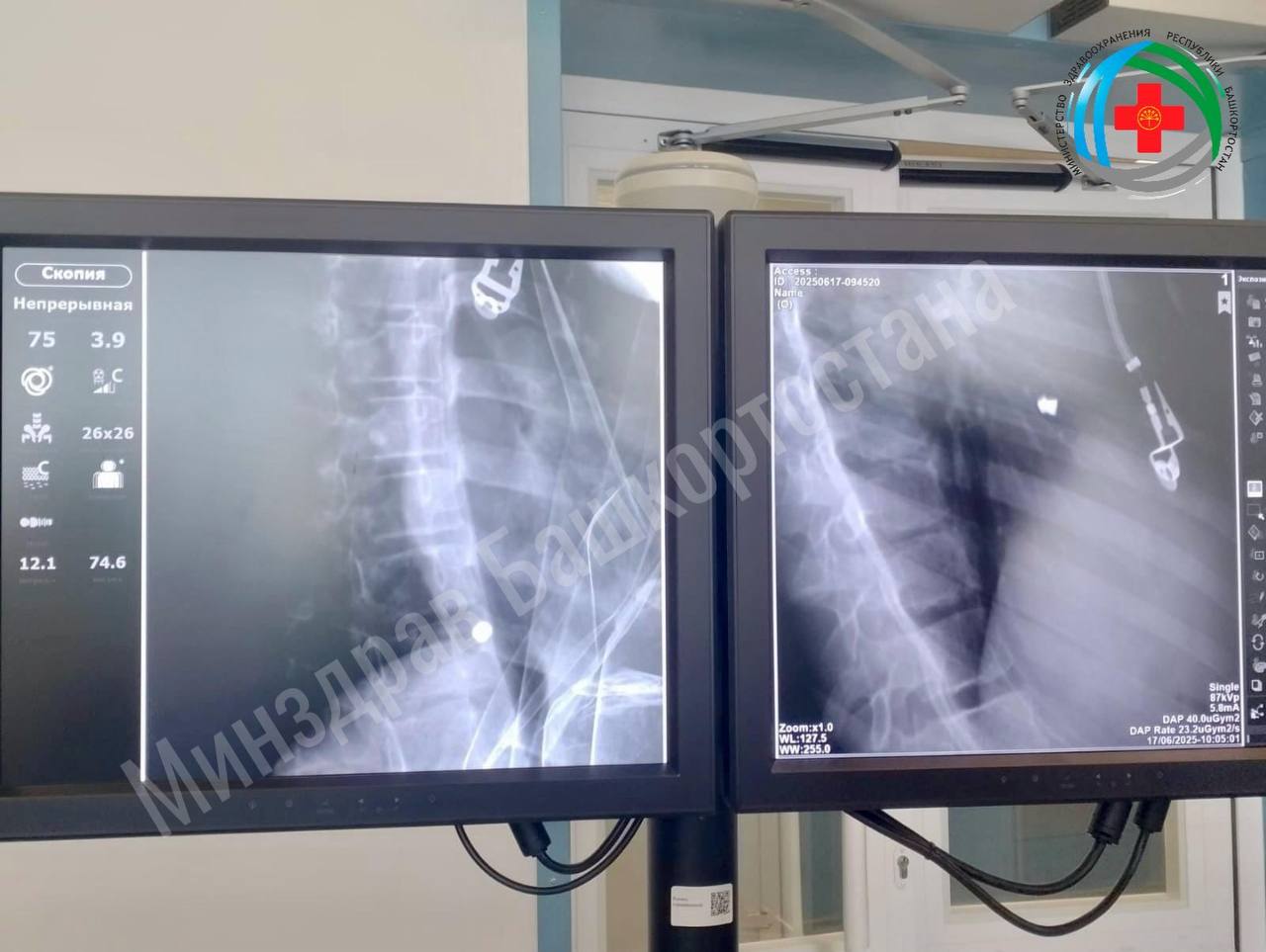 Уфимские врачи спасли жизнь девочке с пулей в сердце